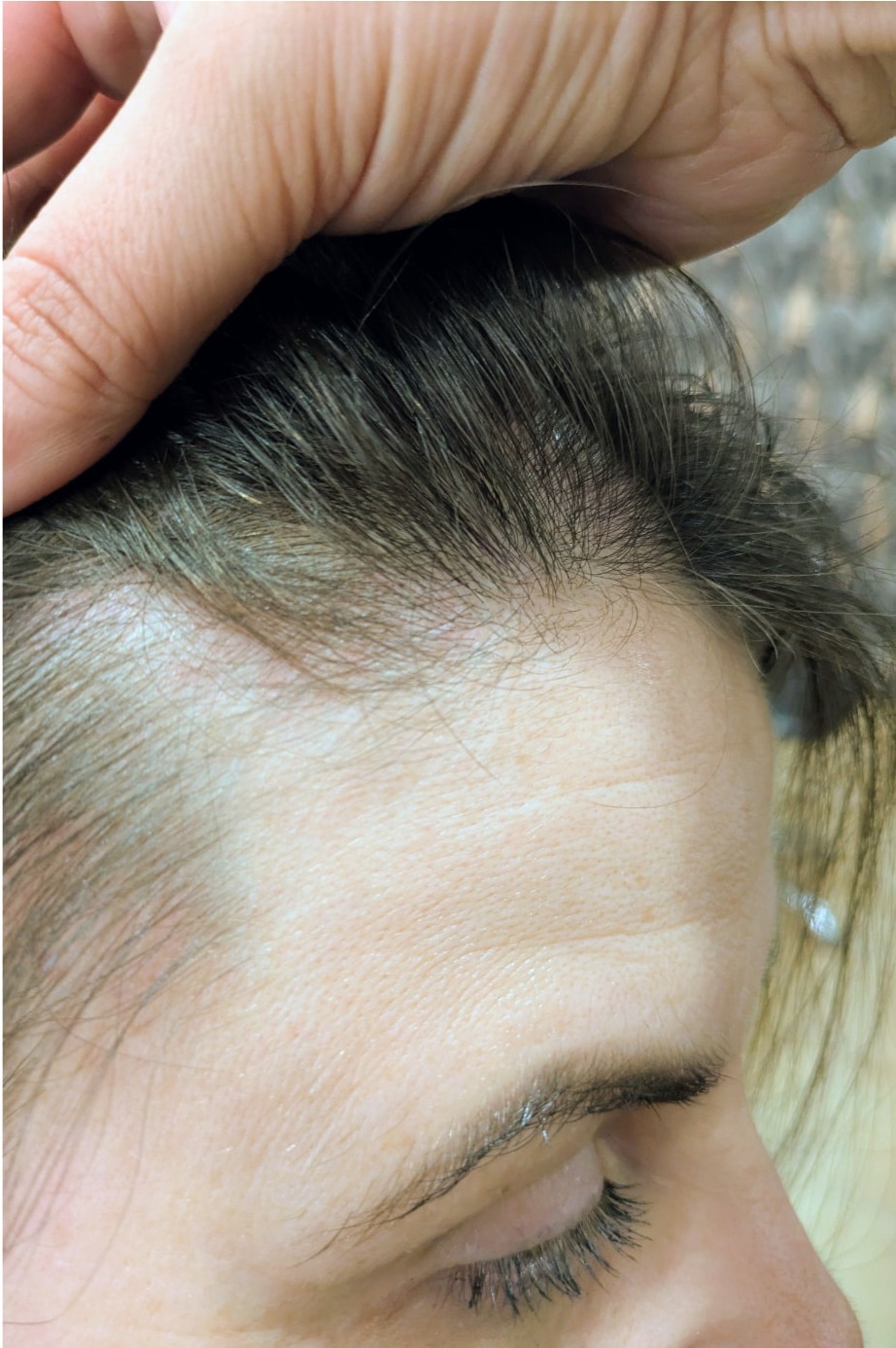 Depois — Caso 3 — Acompanhamento da linha frontal